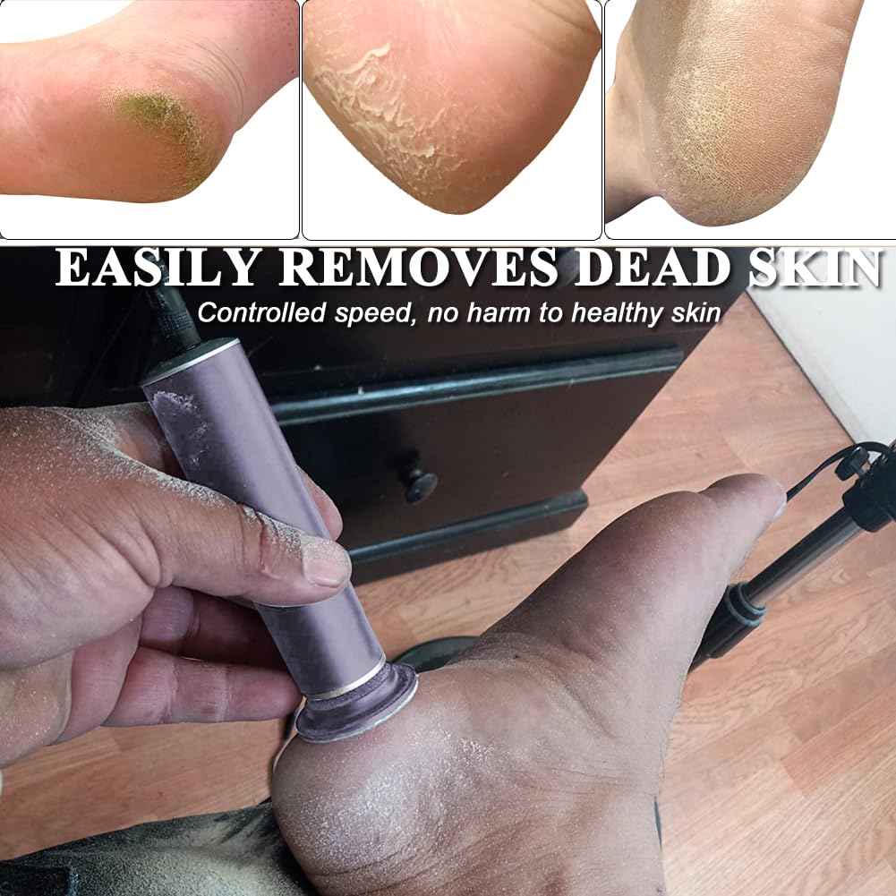 Electric Callus Remover for Feet, Adjustable Various Speed, Powerful Electric Foot File Sander Scrubber Foot Grinder for Dead Skin with 60 Replacement Sanding Discs, 01Gray