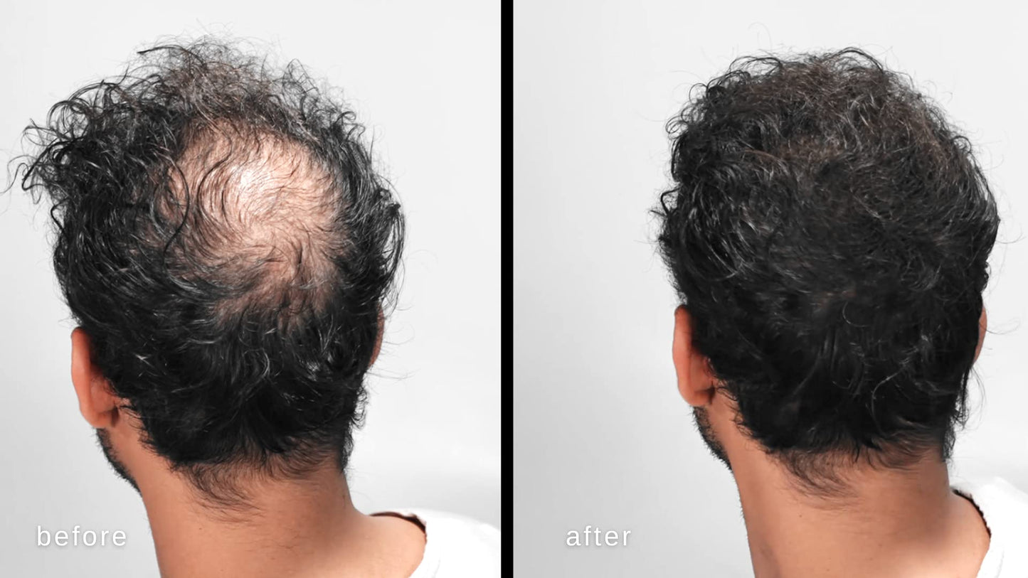 LUXE Hair Thickening Fibers for Unisex, CONFIDENCE IN A JAR, 2 Months+ Supply. Hypoallergenic, Dermatologist Tested, Multiple Colors Available (Black)