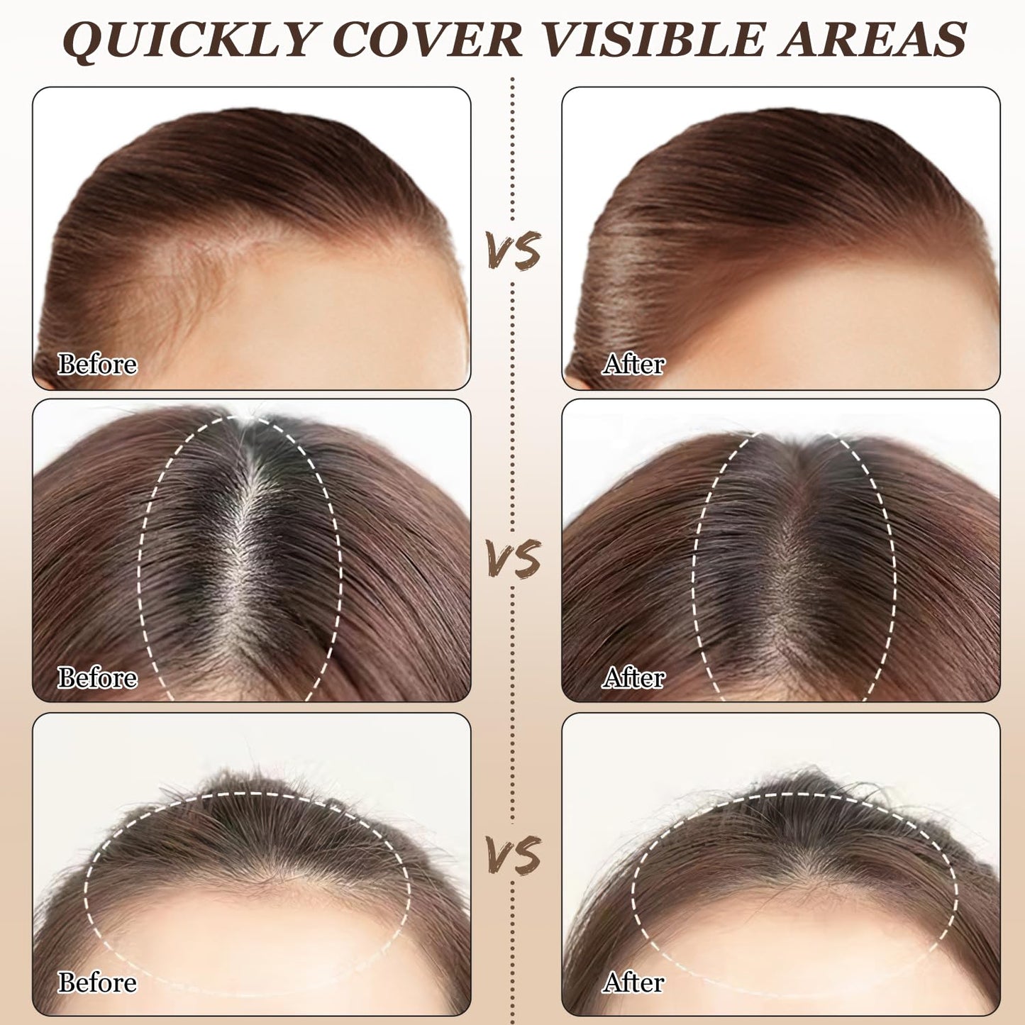 Nicgou Maycheer Hairline Shadow Powder, Maycheer Hair Shadow Root Cover Up, Maycheer Hair Shadow, Hair Line Concealer Root Cover Up, Unisex Root Touch Up Hair Powder (Dark Brown, 01)