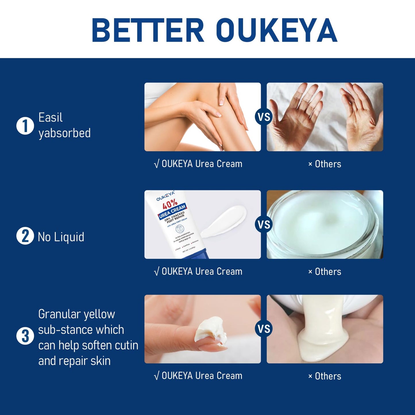 OUKEYA Urea Cream 40 Percent Tube 3 Oz, Urea Foot & Hand Cream for Dry Cracked, 40 per Urea Lotion for Feet Maximum Strength