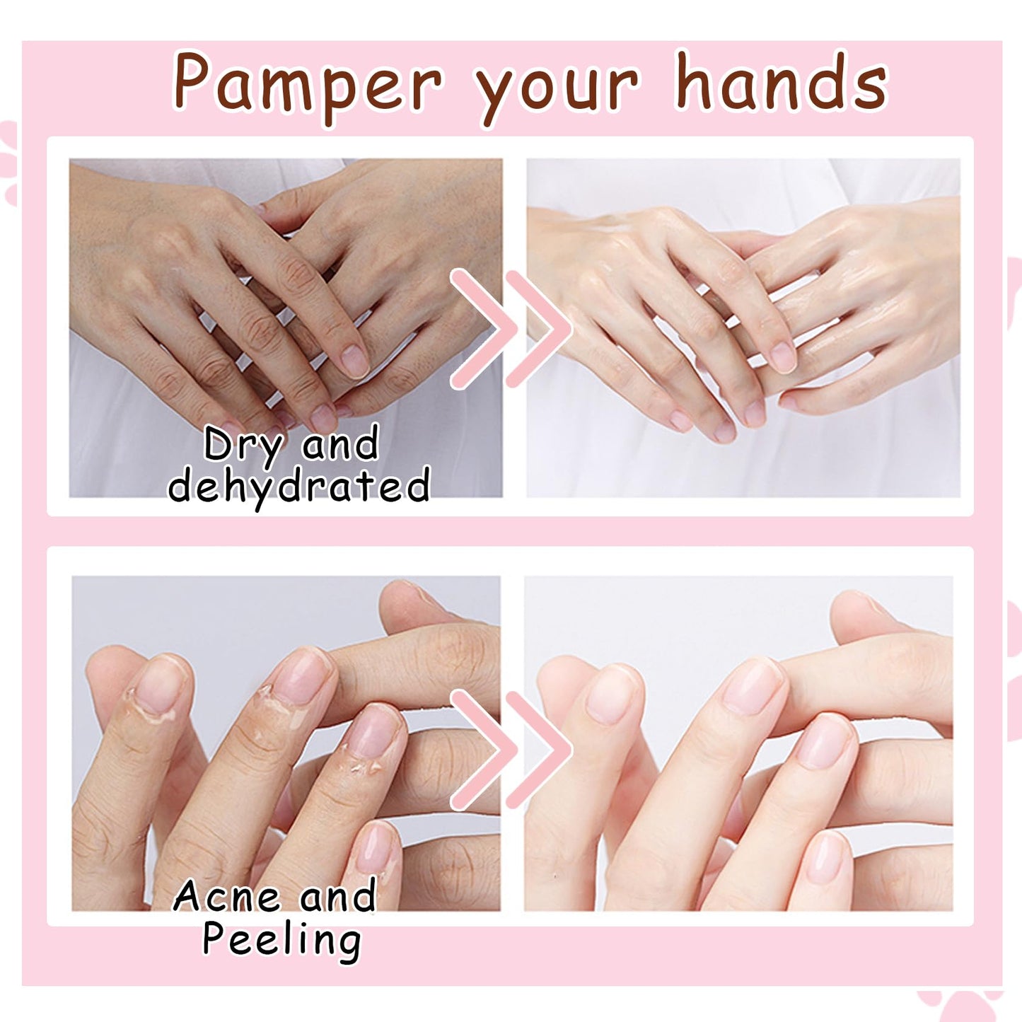 DWDiWen Hand Masks, 6 Pairs Hydrating Exfoliating Hand Peeling Mask, Smooth Hand Masks Moisturizing Gloves Overnight for Dry, Rough, Cracked Hands, Hand Skin Moisturizer Glove for Women Men（D