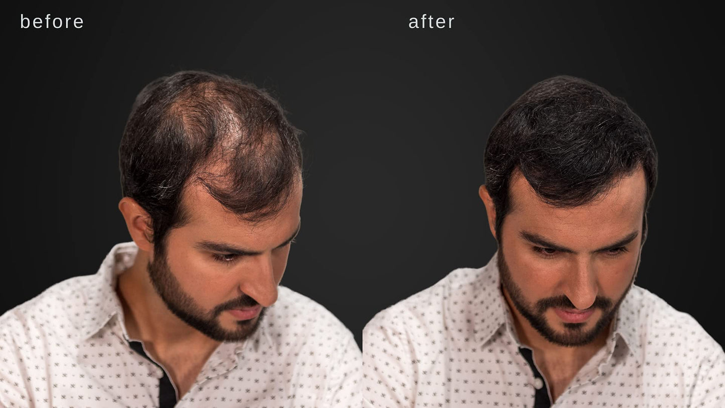 LUXE Hair Thickening Fibers for Unisex, CONFIDENCE IN A JAR, 2 Months+ Supply. Hypoallergenic, Dermatologist Tested, Multiple Colors Available (Black)