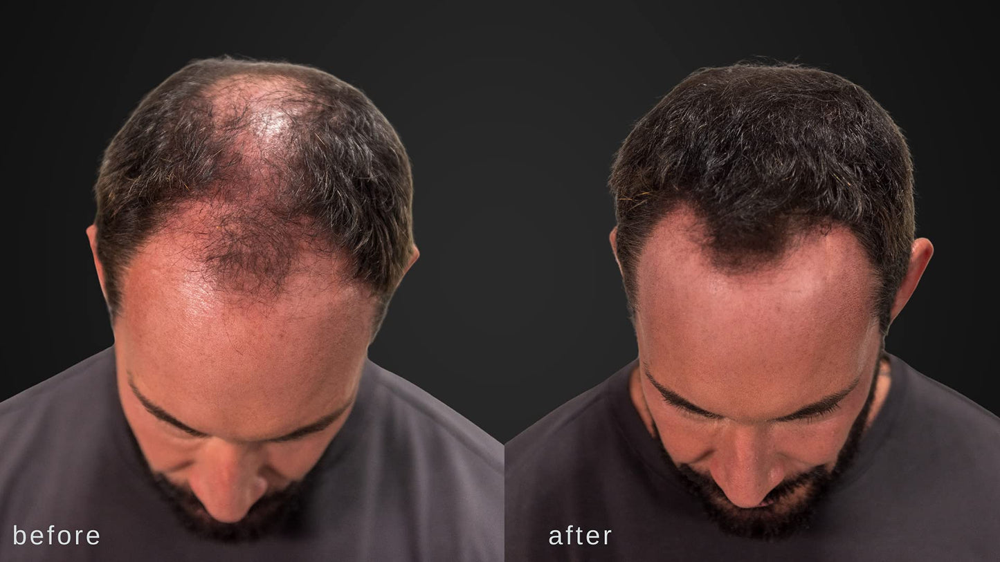 LUXE Hair Thickening Fibers for Unisex, CONFIDENCE IN A JAR, 2 Months+ Supply. Hypoallergenic, Dermatologist Tested, Multiple Colors Available (Black)