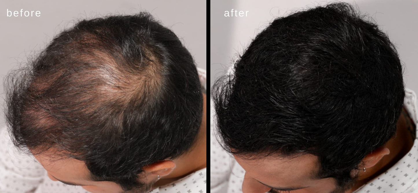 LUXE Hair Thickening Fibers for Unisex, CONFIDENCE IN A JAR, 2 Months+ Supply. Hypoallergenic, Dermatologist Tested, Multiple Colors Available (Black)