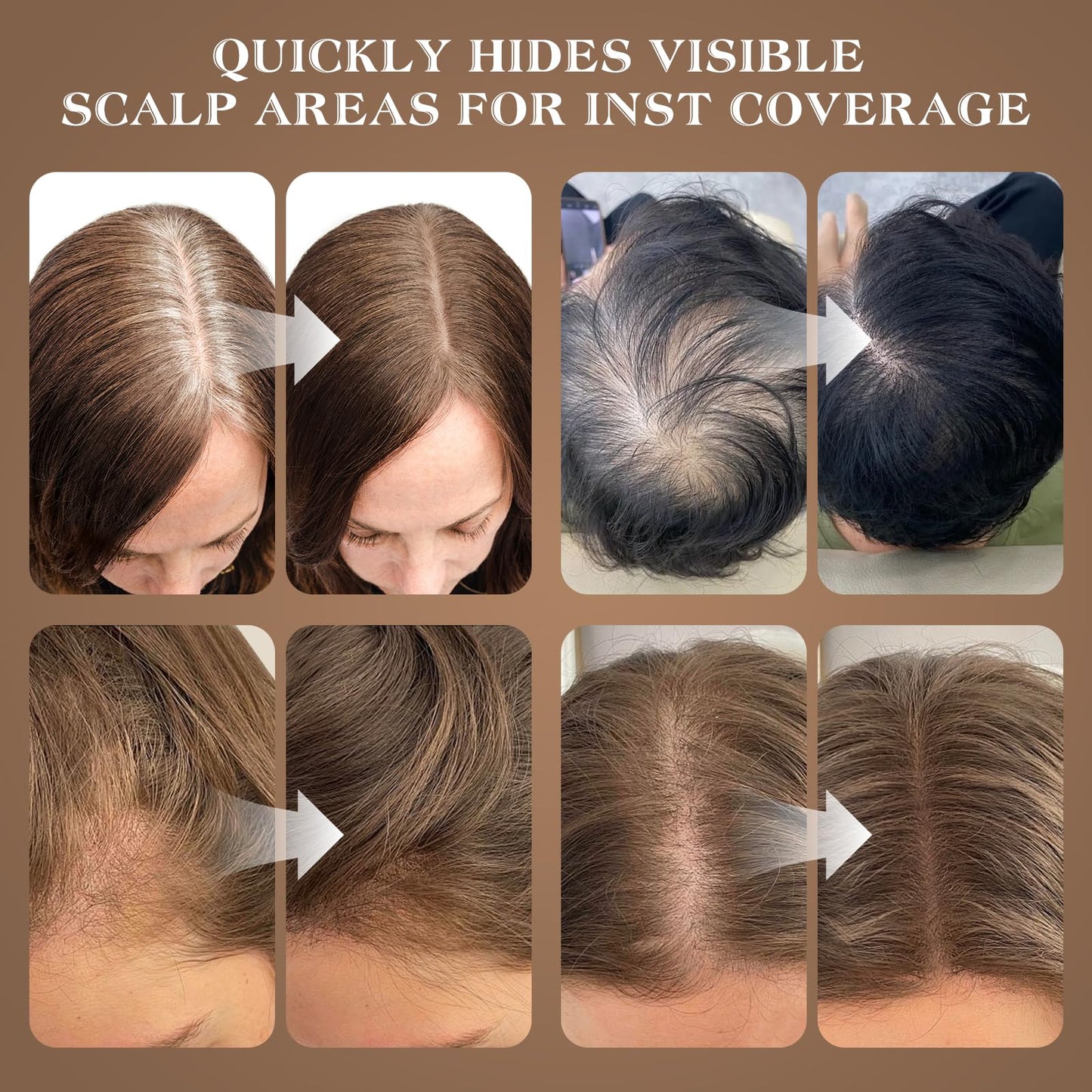 Yargkos Hairline Shadow Powder, Light Brown, Root Touch Up Powder for Instantly Gray Hair Cover Up, Women Color Root Coverage for Thinning Grey, Mens Roots Concealer for Hair Loss Beard Line, #1