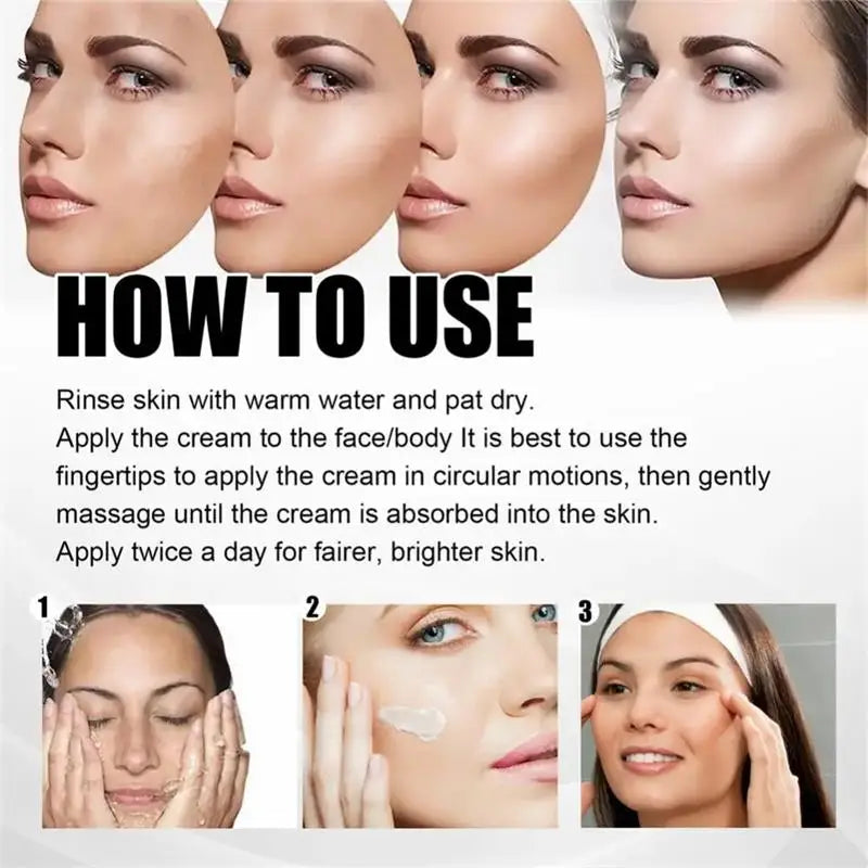 Powerful Spot-removing Whiten Cream Brighten Skin Fast Eliminates Melanin Pigmentation Melasma Dark Spots Moisturize Beauty Gel