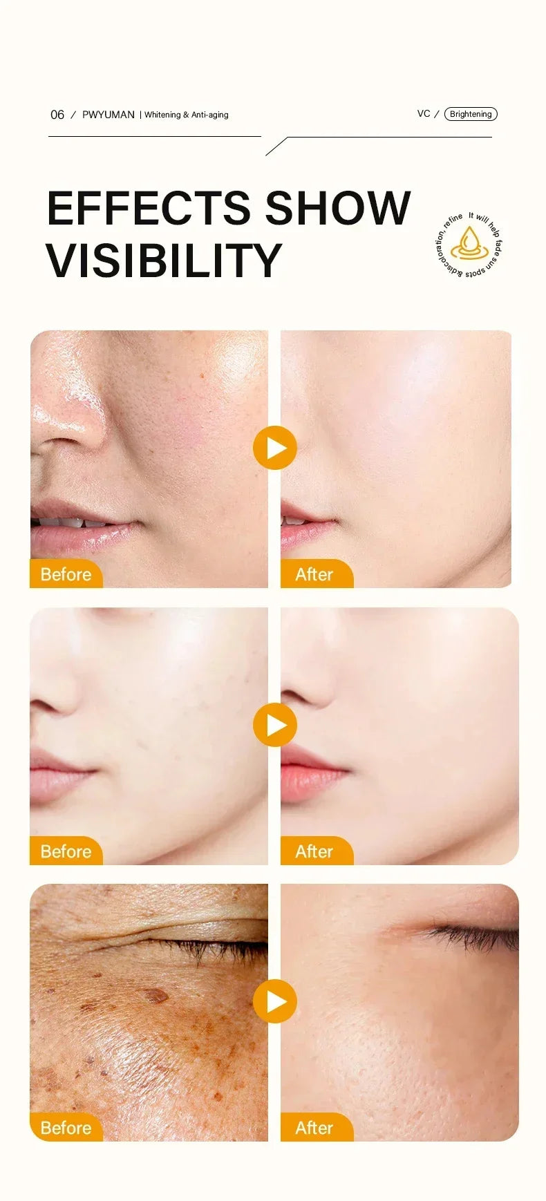 Vitamin C Whitening Freckles Serum Cream Remove Dark Spots Fade Melasma Lighten Melanin Pigment Bleaching Moisturizing Skin Care