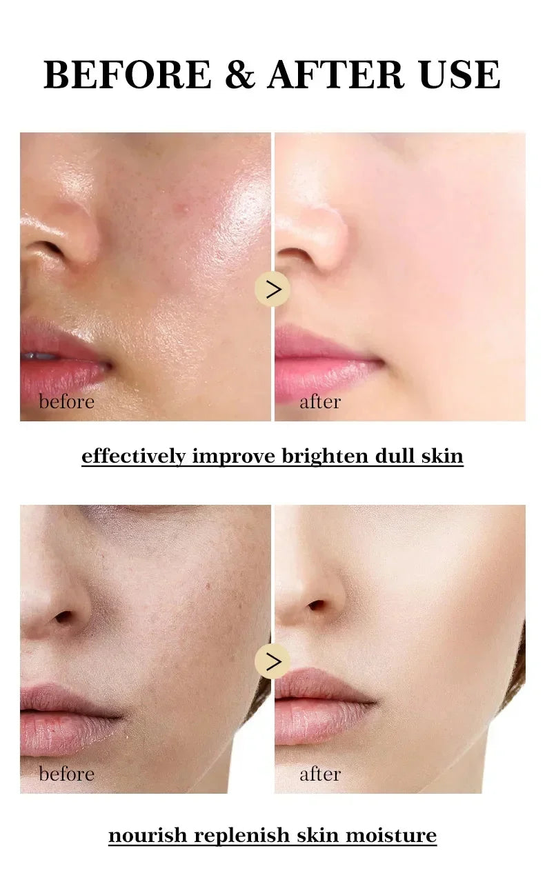 Vitamin C Whitening Freckles Serum Cream Remove Dark Spots Fade Melasma Lighten Melanin Pigment Bleaching Moisturizing Skin Care