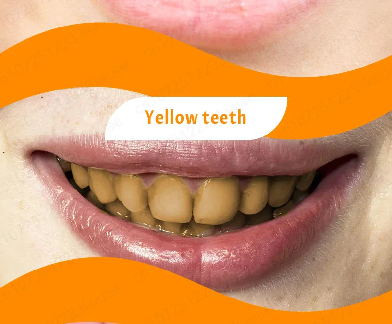 98% repurchase rate, you can have healthy teeth without teeth cleaning, recommended by dentists