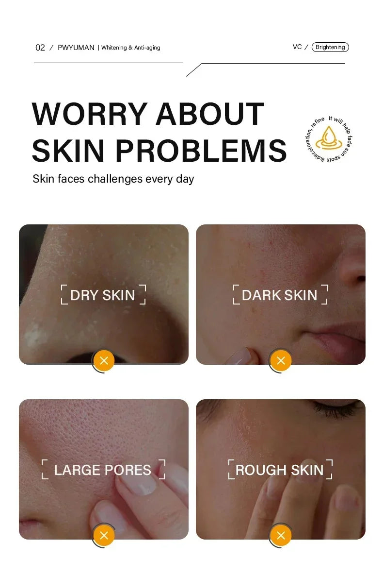Vitamin C Whitening Freckles Serum Cream Remove Dark Spots Fade Melasma Lighten Melanin Pigment Bleaching Moisturizing Skin Care