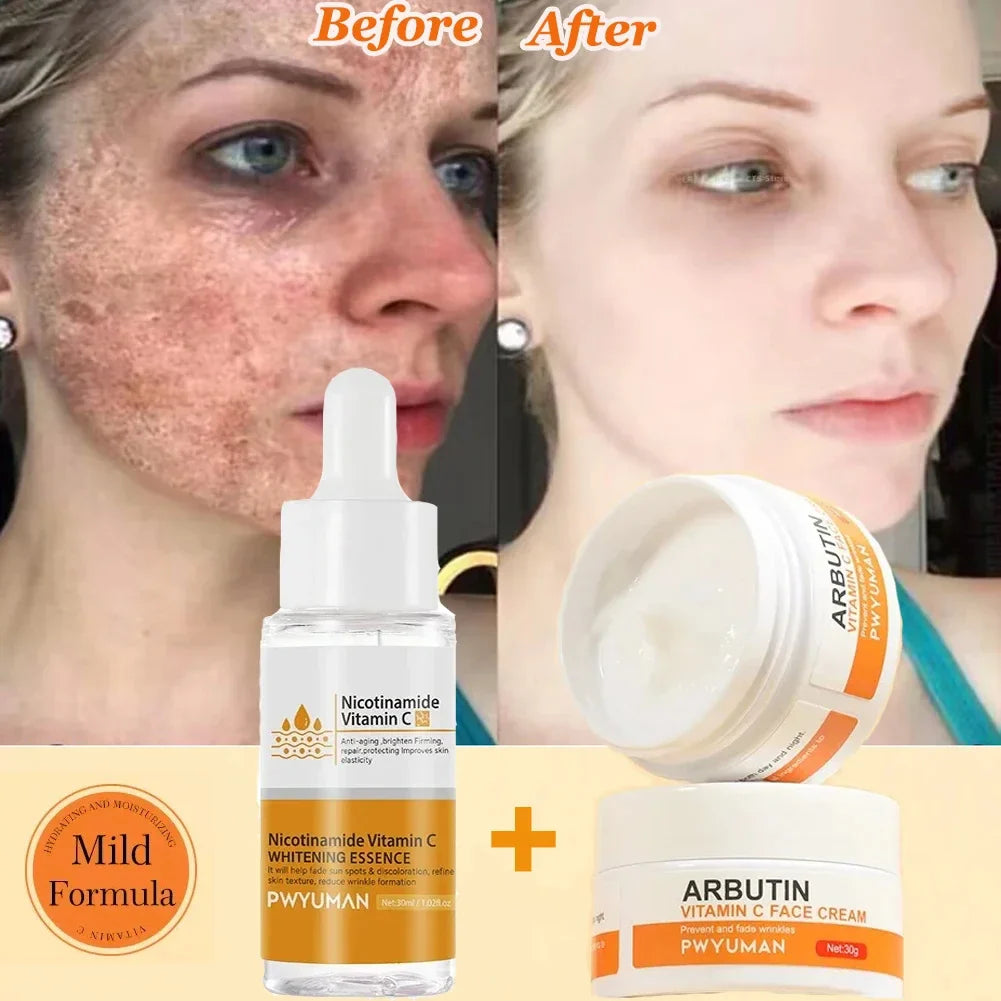 Vitamin C Whitening Freckles Serum Cream Remove Dark Spots Fade Melasma Lighten Melanin Pigment Bleaching Moisturizing Skin Care
