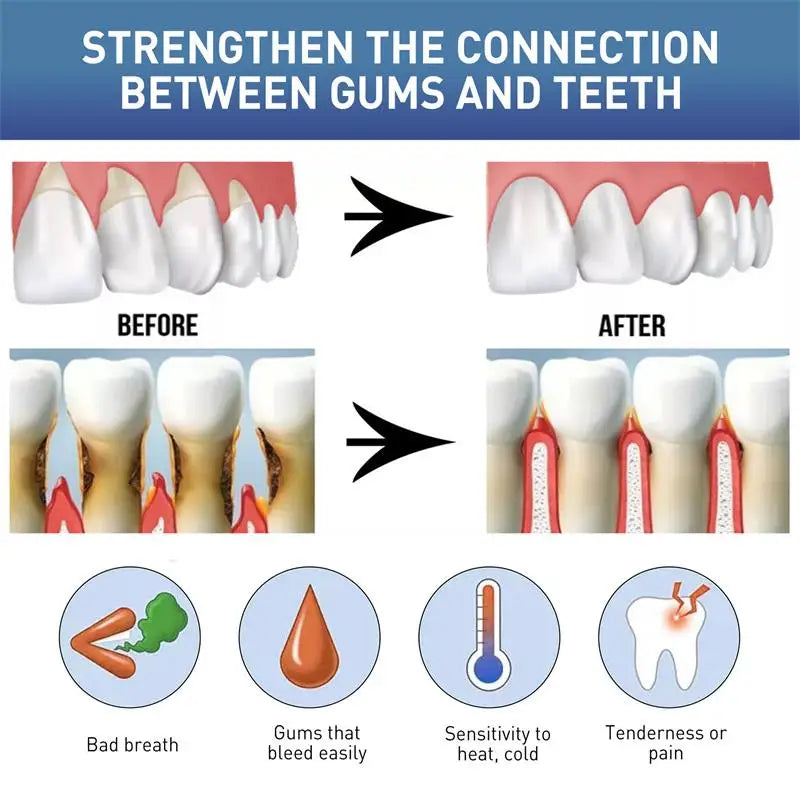 Gum Instant Treatment Gel Relieve Gingival Recession Swelling Pain Clean Plaque Stains Whiten Teeth Anti Gingival Inflammation