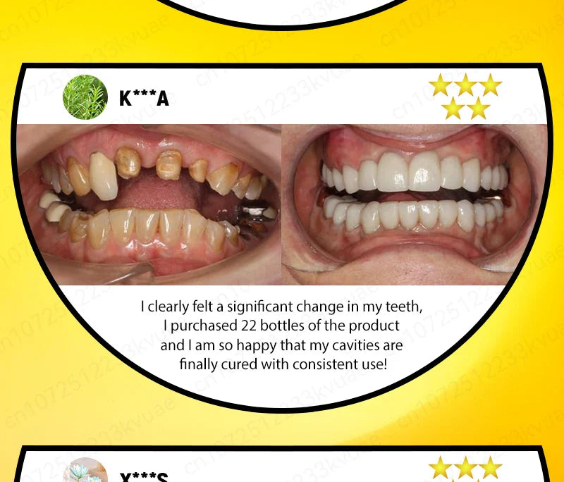 98% repurchase rate, you can have healthy teeth without teeth cleaning, recommended by dentists