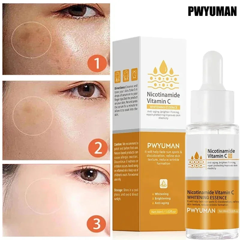 Vitamin C Whitening Freckles Serum Cream Remove Dark Spots Fade Melasma Lighten Melanin Pigment Bleaching Moisturizing Skin Care