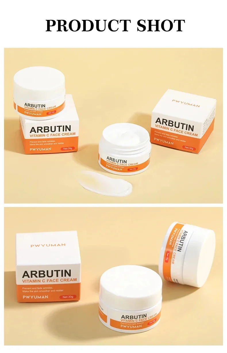 Vitamin C Whitening Freckles Serum Cream Remove Dark Spots Fade Melasma Lighten Melanin Pigment Bleaching Moisturizing Skin Care