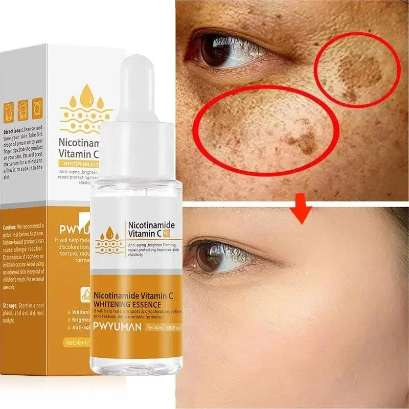 Vitamin C Whitening Freckles Serum Cream Remove Dark Spots Fade Melasma Lighten Melanin Pigment Bleaching Moisturizing Skin Care