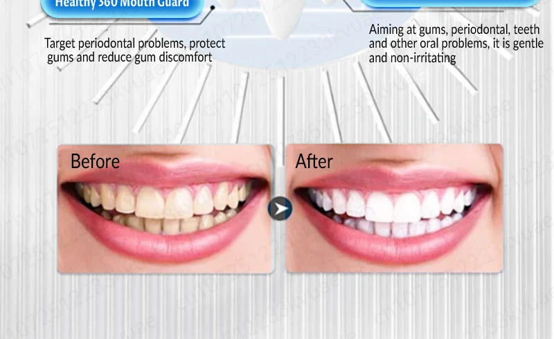 98% repurchase rate, you can have healthy teeth without teeth cleaning, recommended by dentists